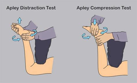 apley's test positive meniscus tear|apley's scratch test positive.